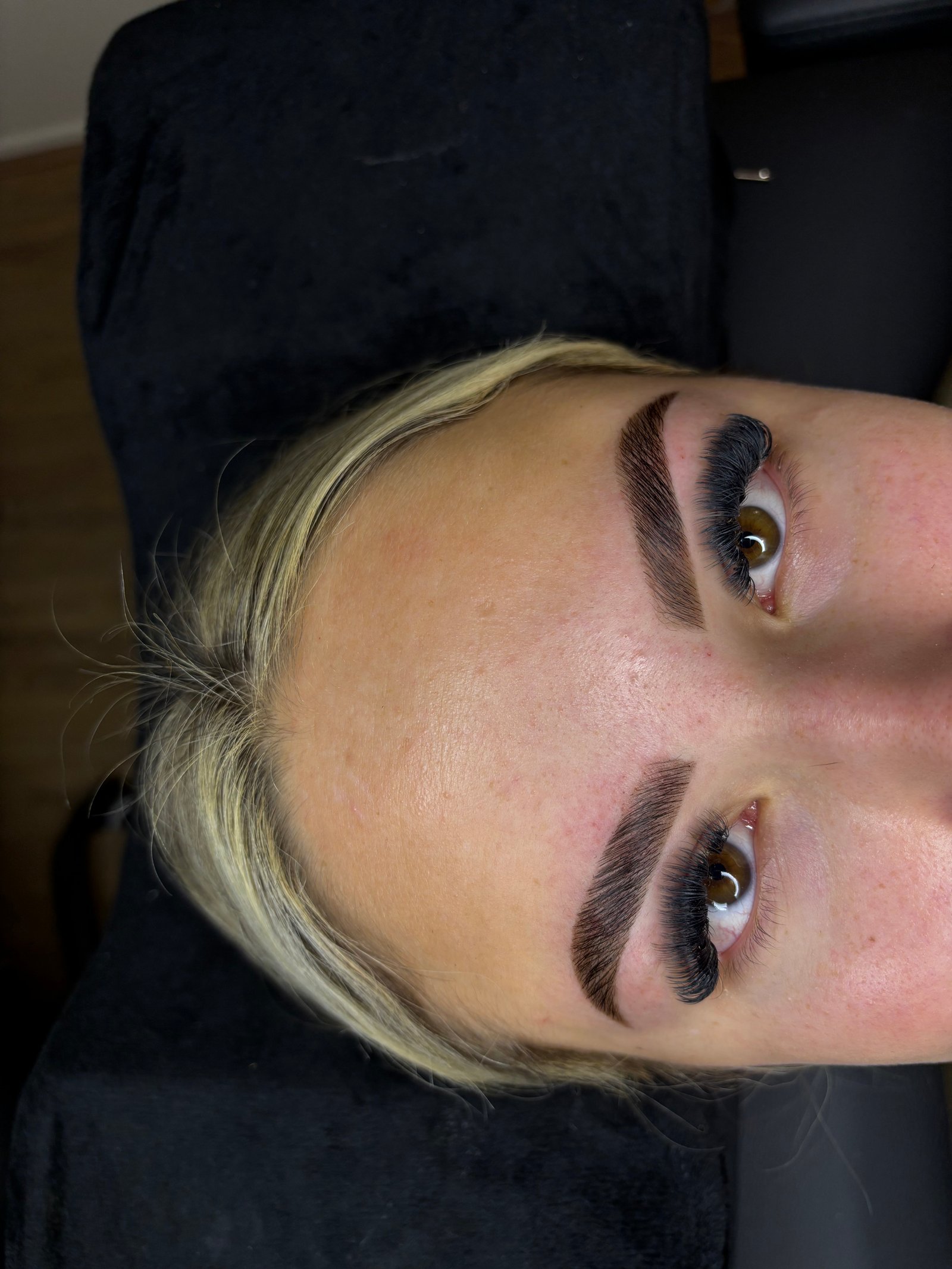 Brow treatment